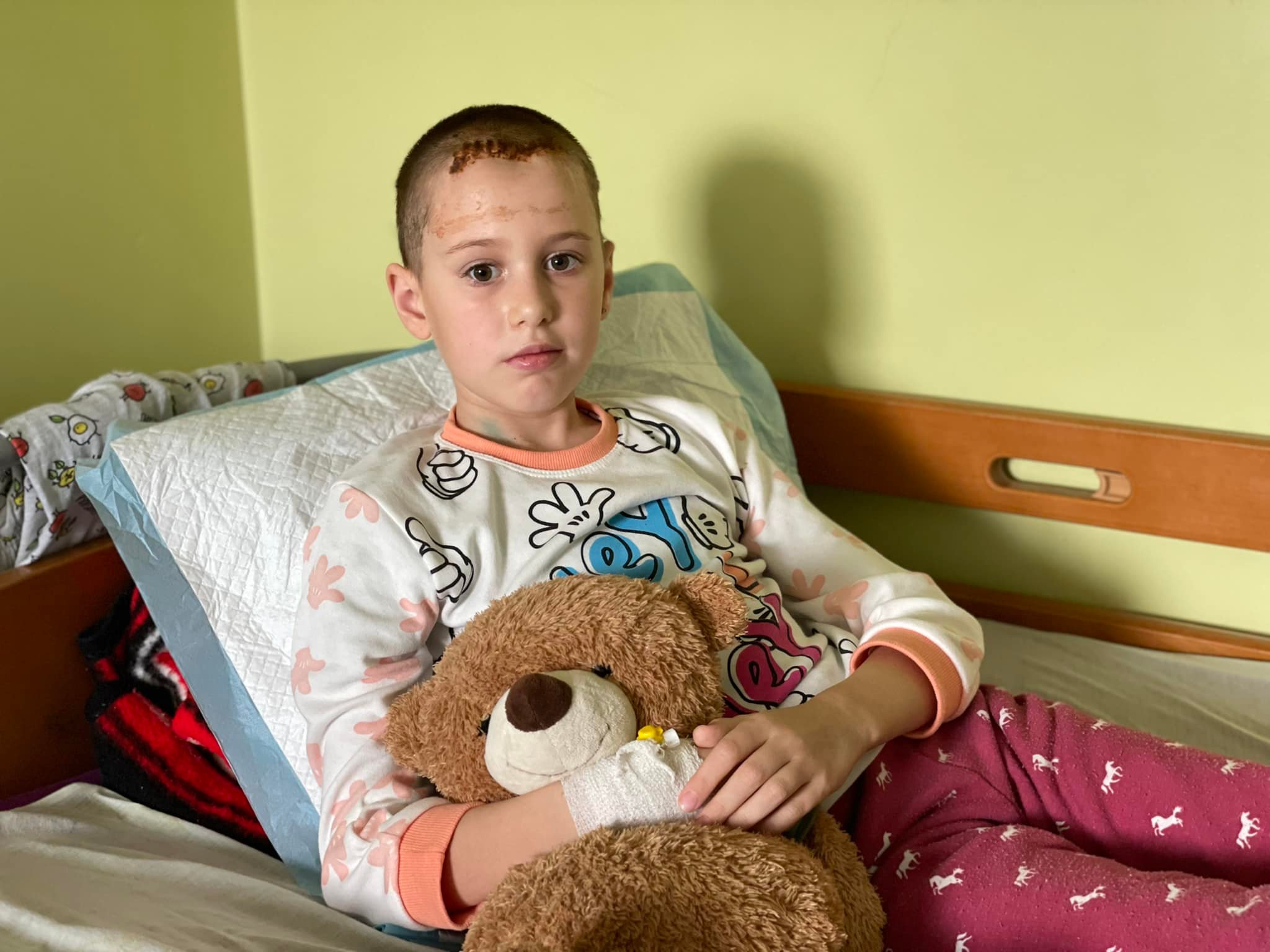 У львівській лікарні врятували 9-річну Софійку, якій крізь мозок пройшов уламок касетного снаряду