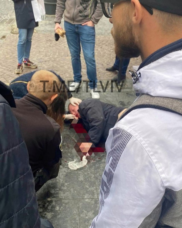 Потерпілий львів'янин. Фото: Типовий Львів