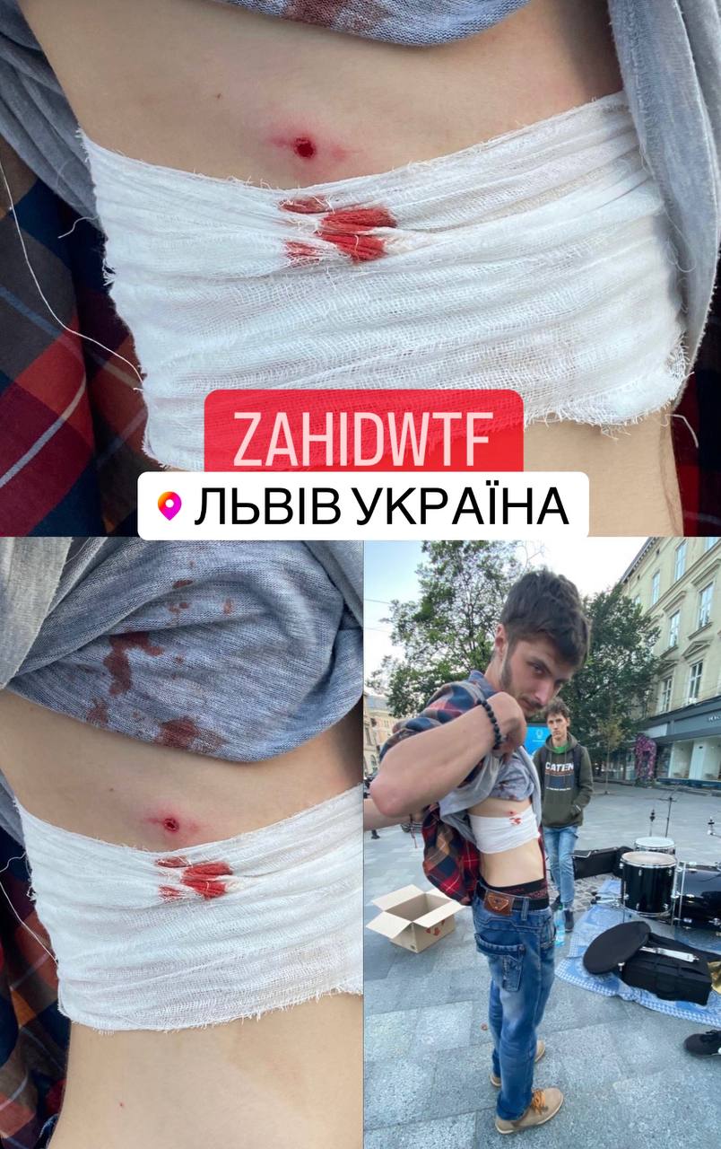 У Львові невідомий вистрілив у вуличного музиканта під час виступу у центрі міста